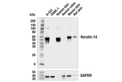 Cell Signaling Technology&nbsp;Keratin 14 E7J5W Rabbit mAb