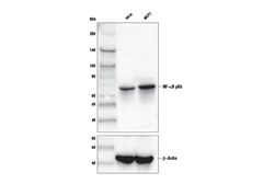 Cell Signaling Technology NF-kappa-B p65 D14E12 XPR