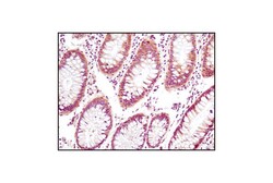 Cell Signaling Technology&nbsp;PTEN and PDK1 Antibody Sampler