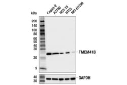 Cell Signaling Technology&nbsp;TMEM41B F6F4Z Rabbit mAb 100