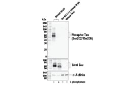 Cell Signaling Technology&nbsp;Phospho-Tau Ser202/Thr205 E