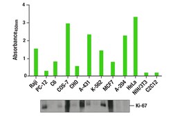 Cell Signaling Technology&nbsp;Total Ki-67 Matched Antibody P