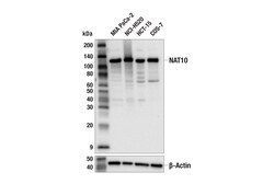 Cell Signaling Technology&nbsp;NAT10 E5U9W Rabbit mAb 100 u