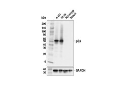 Cell Signaling Technology&nbsp;p53 E9B5W Rabbit mAb 100 ul