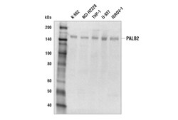 Cell Signaling Technology&nbsp;PALB2 E9R2W Rabbit mAb 100 u