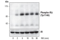 Cell Signaling Technology&nbsp;Phospho-IGF-I Receptor beta T