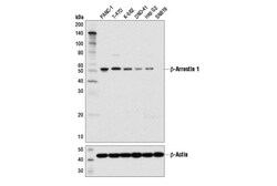 Cell Signaling Technology&nbsp;beta-Arrestin 1 D7Z3W XPR