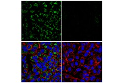 Cell Signaling Technology&nbsp;MTX1 E4O1L Rabbit mAb 100 ul