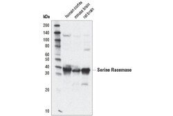 Cell Signaling Technology Serine Racemase D5V9Z Rabbit