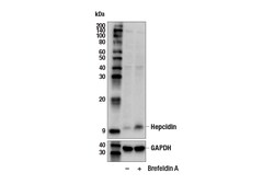 Cell Signaling Technology&nbsp;Hepcidin E8M5B Rabbit mAb 10