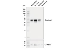 Cell Signaling Technology Enolase-2 E2H9X XPR Rabbit