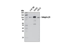 Cell Signaling Technology Integrin beta-3 D7X3P XPR