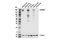 Cell Signaling Technology&nbsp;SHANK2 D1N4C Rabbit mAb 100