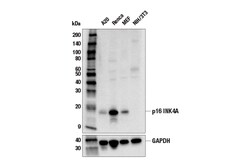 Cell Signaling Technology&nbsp;p16 INK4A E5F3Y Rabbit mAb 1