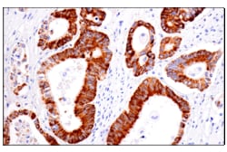 Cell Signaling Technology&nbsp;AMACR F7T6V Rabbit mAb 100 u