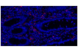 Cell Signaling Technology HLA-DRA E9R2Q XPR Rabbit m