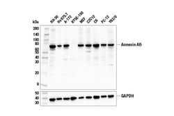 Cell Signaling Technology&nbsp;Annexin A6 Antibody 100 ul