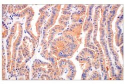 Cell Signaling Technology&nbsp;B-Raf V600E Mutant IHC600