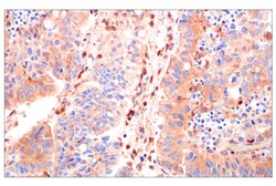 Cell Signaling Technology&nbsp;ROCK1 E2G4N Rabbit mAb 100 u