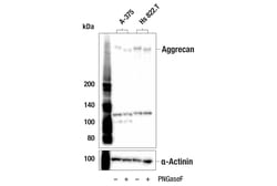 Cell Signaling Technology&nbsp;Aggrecan E8B8S Rabbit mAb 10