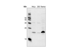 Cell Signaling Technology&nbsp;p18 INK4C DCS118 Mouse mAb 2