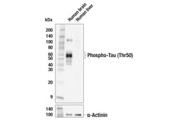 Cell Signaling Technology&nbsp;Phospho-Tau Thr50 F9Y2M Ra
