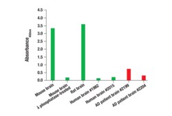Cell Signaling Technology&nbsp;Phospho-Tau Ser396 Matched A