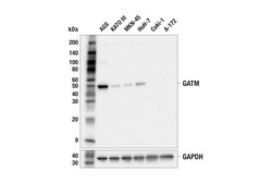 Cell Signaling Technology&nbsp;GATM F6S8W Rabbit mAb 100 ul