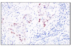Cell Signaling Technology&nbsp;FRA1 F2C9L Rabbit mAb IHC F