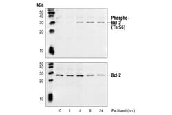 Cell Signaling Technology&nbsp;Phospho-Bcl-2 Thr56 Antibody