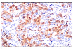 Cell Signaling Technology&nbsp;Thymidine Kinase 1 E2H7Z Rab