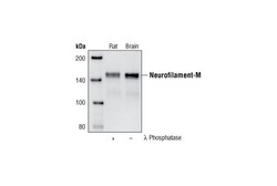 Cell Signaling Technology&nbsp;Neurofilament-M RMO 14.9 Mou