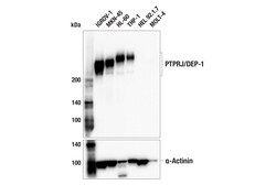 Cell Signaling Technology&nbsp;PTPRJ/DEP-1 F4G8K Rabbit mAb