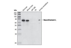 Cell Signaling Technology&nbsp;Neurofilament-L DA2 Mouse mA