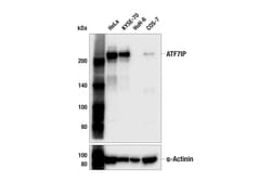 Cell Signaling Technology&nbsp;ATF7IP F8C9I Rabbit mAb 100