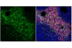 Cell Signaling Technology&nbsp;CD5 E5O4W Rabbit mAb 100 ul