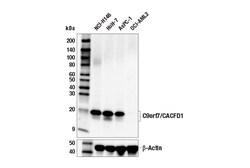 Cell Signaling Technology&nbsp;C9orf7/CACFD1 E6E3J Rabbit m