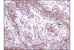 Cell Signaling Technology&nbsp;LKB1 D60C5F10 Rabbit mAb BS