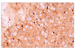 Cell Signaling Technology&nbsp;S100B E9F2I Rabbit mAb 100 u