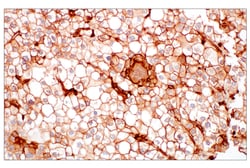Cell Signaling Technology&nbsp;MHC Class I EMR8-5 Mouse mAb