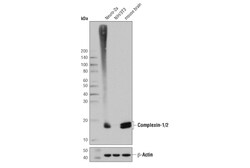Cell Signaling Technology&nbsp;Complexin-1/2 D8A6E Rabbit m