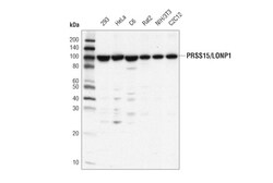 Cell Signaling Technology&nbsp;PRSS15/LONP1 D8W1J Rabbit mA