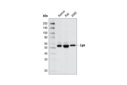 Cell Signaling Technology&nbsp;Lyn C13F9 Rabbit mAb 20 ul