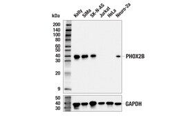 Cell Signaling Technology&nbsp;PHOX2B E4Q9R Rabbit mAb 100
