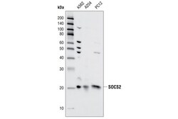 Cell Signaling Technology&nbsp;SOCS2 Antibody 20 ul
