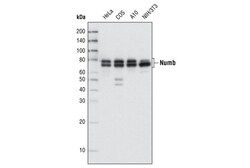 Cell Signaling Technology&nbsp;Numb C29G11 Rabbit mAb 20 ul