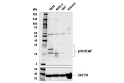 Cell Signaling Technology&nbsp;HBEGF E5L5T Rabbit mAb 100 u