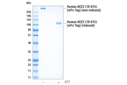 Cell Signaling Technology Human ACE2 18-615 Recombinan