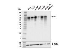 Cell Signaling Technology&nbsp;Dab2 F9K9T Rabbit mAb 100 ul