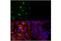Cell Signaling Technology&nbsp;Periostin E3X1U Rabbit mAb 1